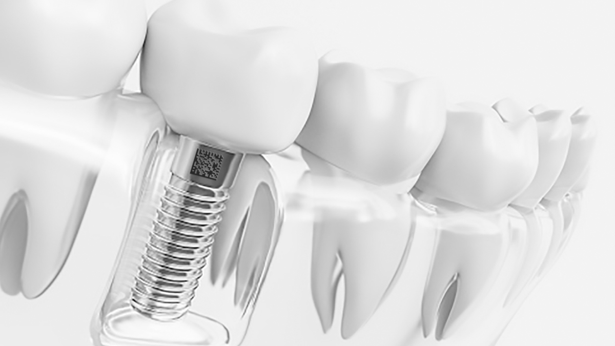 Laser marking and traceability for dental implants and tools