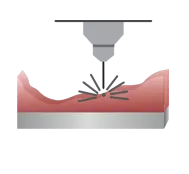 2D laser deep engraving