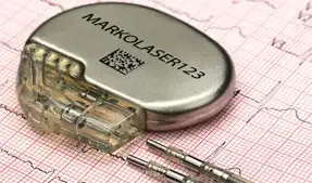 Pace Maker Laser Marking